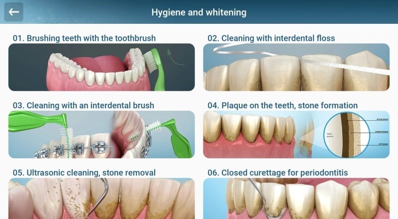 Dental 3D Illustrations